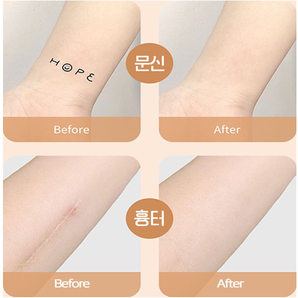 타투커버 스티커